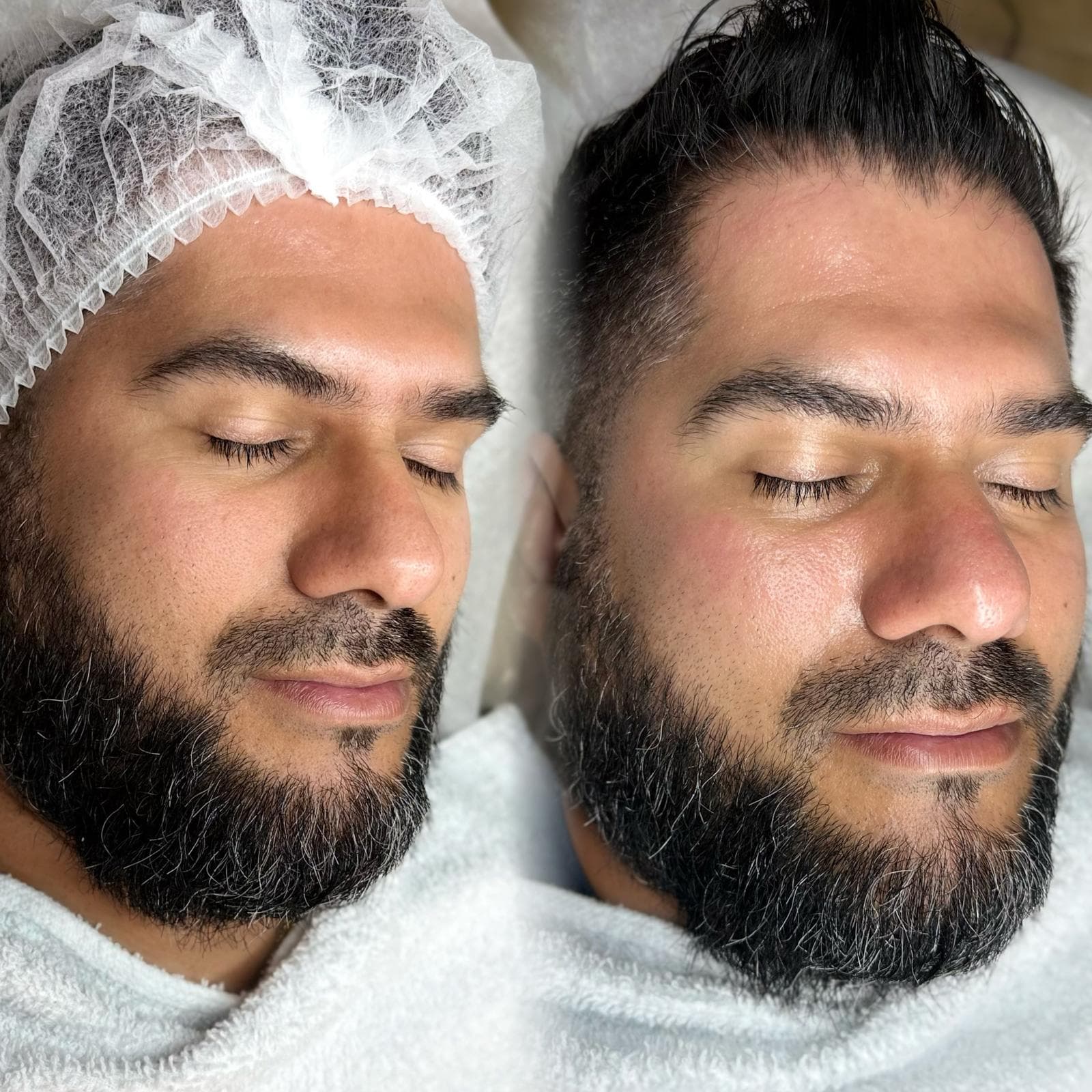 Signature Facials 3